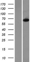 Choline dehydrogenase (CHDH) Human Over-expression Lysate