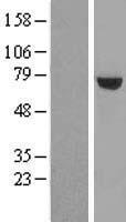 UTP6 Human Over-expression Lysate
