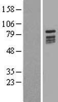 C20orf19 (KIZ) Human Over-expression Lysate