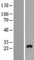 TMEM111 (EMC3) Human Over-expression Lysate