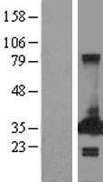 PECR Human Over-expression Lysate