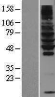 RNF130 Human Over-expression Lysate
