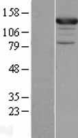 ASAP1 Human Over-expression Lysate