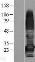 TMEM176A Human Over-expression Lysate