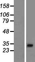 AP1AR Human Over-expression Lysate