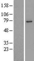USP49 Human Over-expression Lysate