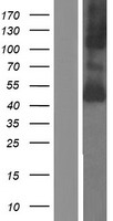 SLC16A10 Human Over-expression Lysate