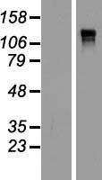 Anillin (ANLN) Human Over-expression Lysate