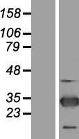 ZNF313 (RNF114) Human Over-expression Lysate