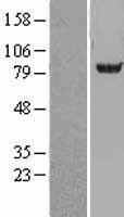 Acetyl CoA synthetase (ACSS2) Human Over-expression Lysate