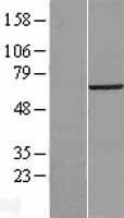 VPS33B Human Over-expression Lysate