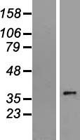 SLC35E3 Human Over-expression Lysate