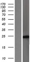 RAC1 Human Over-expression Lysate