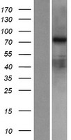 RED2 (ADARB2) Human Over-expression Lysate