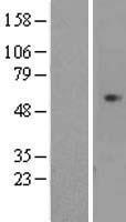 CDCA7L Human Over-expression Lysate