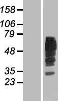 RAB5IF Human Over-expression Lysate