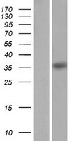 HMX1 Human Over-expression Lysate
