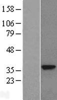 GNMT Human Over-expression Lysate
