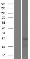 STAG3L1 Human Over-expression Lysate