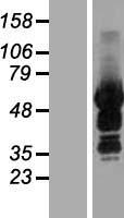 SASH3 Human Over-expression Lysate