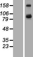 TBC1D16 Human Over-expression Lysate
