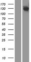 DHX29 Human Over-expression Lysate