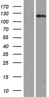 USP53 Human Over-expression Lysate
