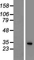 SGTB Human Over-expression Lysate