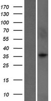 WDR5B Human Over-expression Lysate