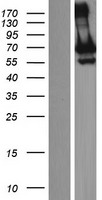 GNL3L Human Over-expression Lysate