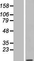 TOMM7 Human Over-expression Lysate