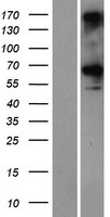 CCDC76 (TRMT13) Human Over-expression Lysate