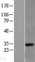 LIN37 Human Over-expression Lysate