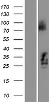 C21orf62 Human Over-expression Lysate