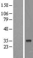 MTFR1L Human Over-expression Lysate