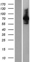 INPP5E Human Over-expression Lysate