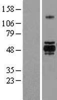 GSK3 alpha (GSK3A) Human Over-expression Lysate