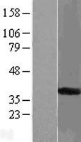 START domain containing 7 (STARD7) Human Over-expression Lysate