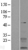 TMEM167B Human Over-expression Lysate