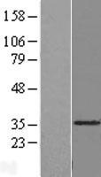 C14orf124 (SDR39U1) Human Over-expression Lysate