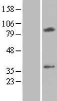 C16orf61 (CMC2) Human Over-expression Lysate