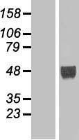LHX9 Human Over-expression Lysate