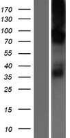 CHPT1 Human Over-expression Lysate