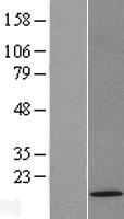 TOMM22 Human Over-expression Lysate