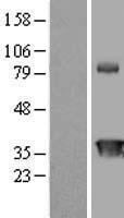CIAPIN1 Human Over-expression Lysate