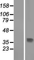 THAP10 Human Over-expression Lysate