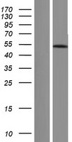 beta Arrestin 1 (ARRB1) Human Over-expression Lysate
