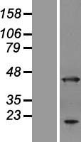 ANKRD2 Human Over-expression Lysate