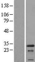PCNP Human Over-expression Lysate