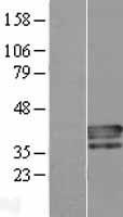 PLSCR4 Human Over-expression Lysate
